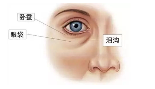  国内中医体质辨识辨识仪探讨眼袋和人体九大体质的关系及中医去眼袋